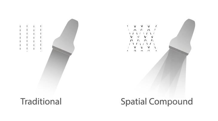 Spatial Compound Imaging