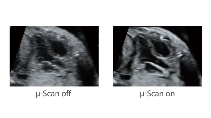 μ-Scan+