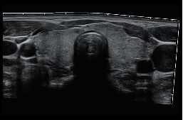 SR-Flow Ultrasound