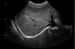 SR-Flow Ultrasound