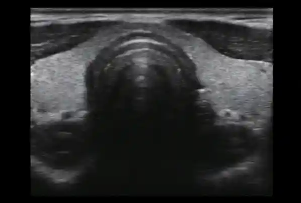 e1-test-3