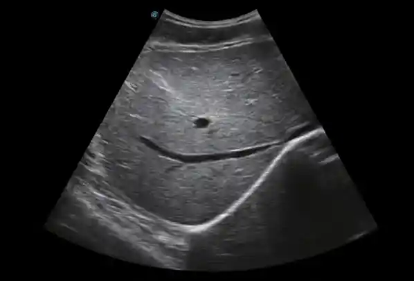 e1-test-4