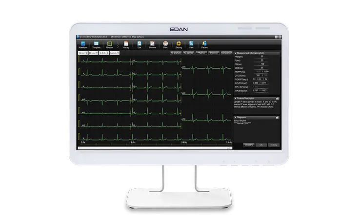 PC-ECG-SE-1515_05