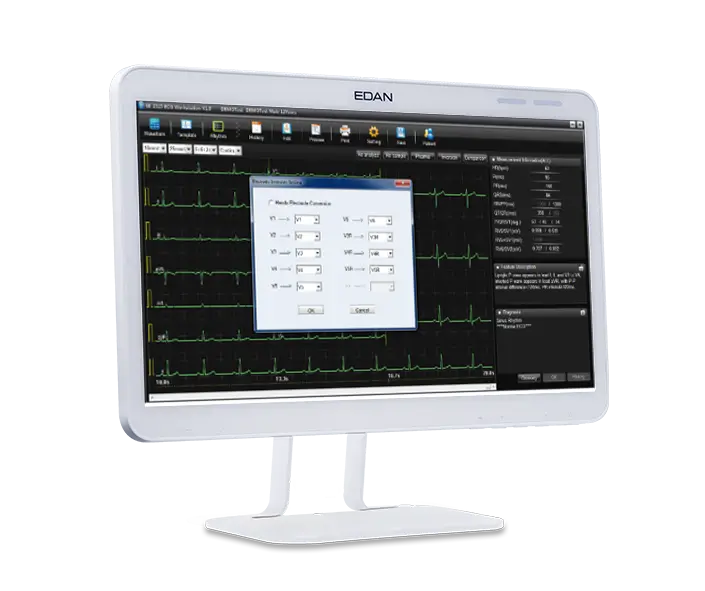 PC-ECG-SE-1515_06