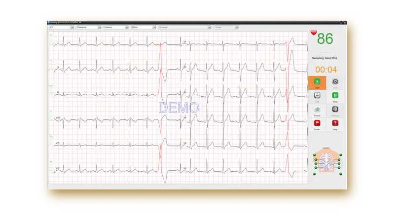 PC-ECG-SE-1515_08