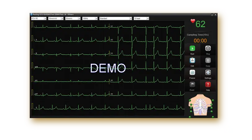 PC-ECG-SE-1515_12