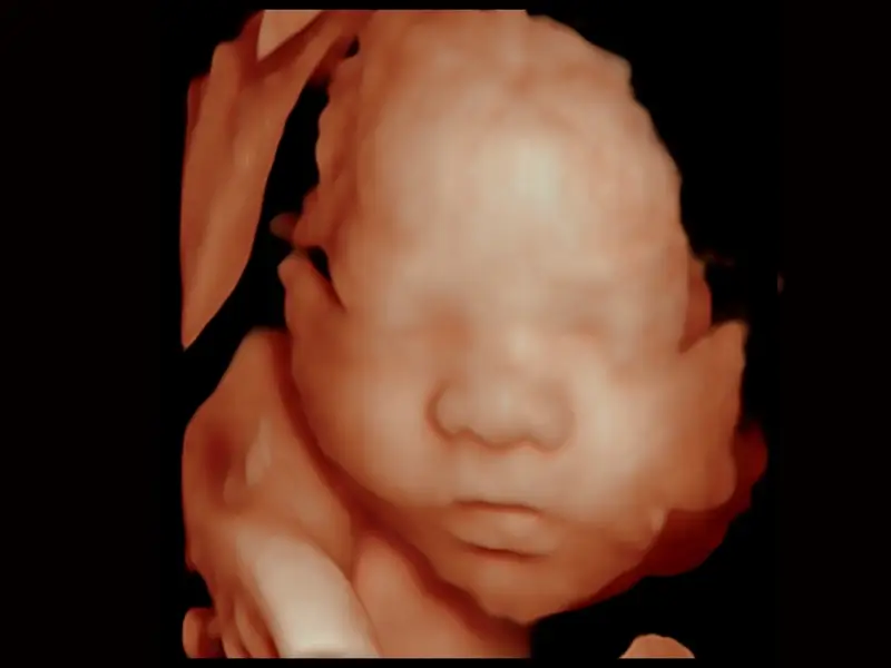 Baby Face Rendering With S-Live