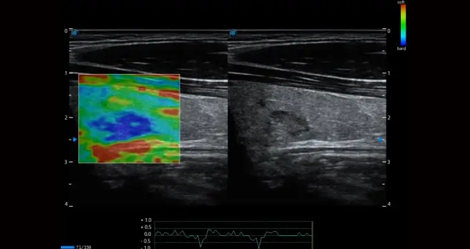 C-xlasto Imaging