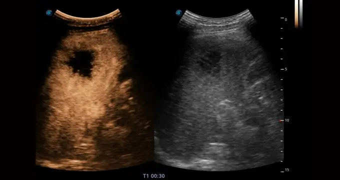 Contrast-Imaging