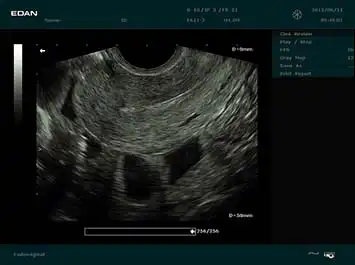 e1-test-2