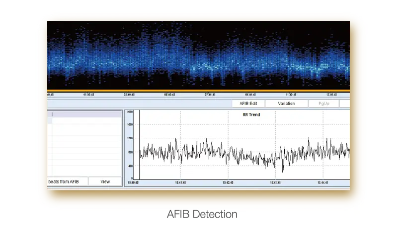holter-system-se-2012_08