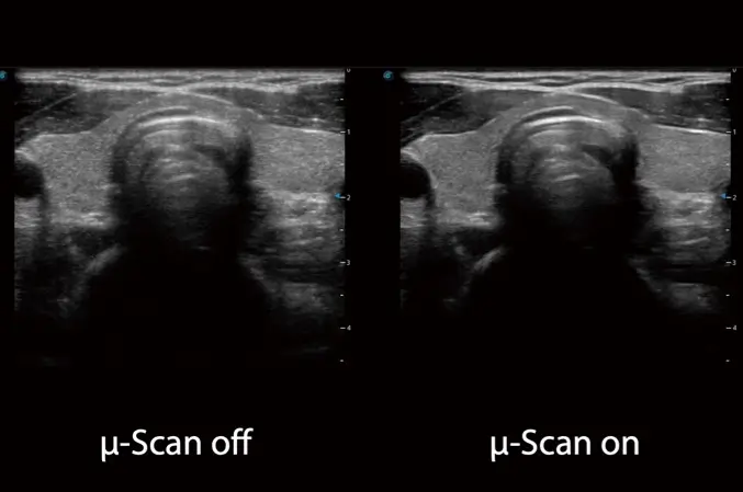 m-scan