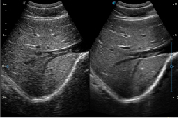 μ-Scan Imaging