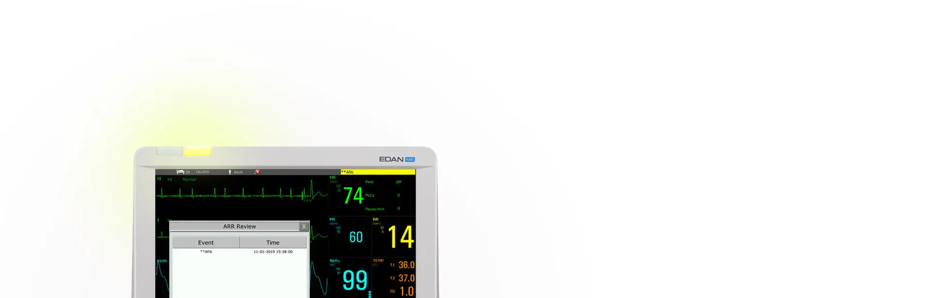 patient-monitor-im-04
