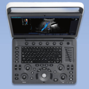 sonoscape ultrusound E2