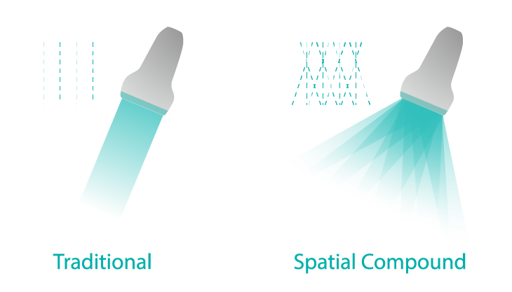 Spatial Compound Imaging